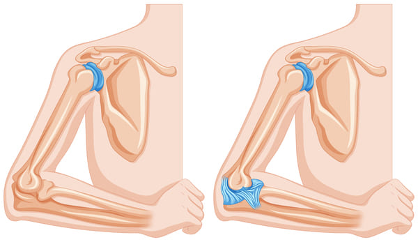 Magnetum Arthro